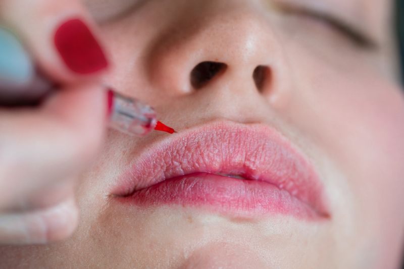 Trajna šminka usana - Estetique Prive